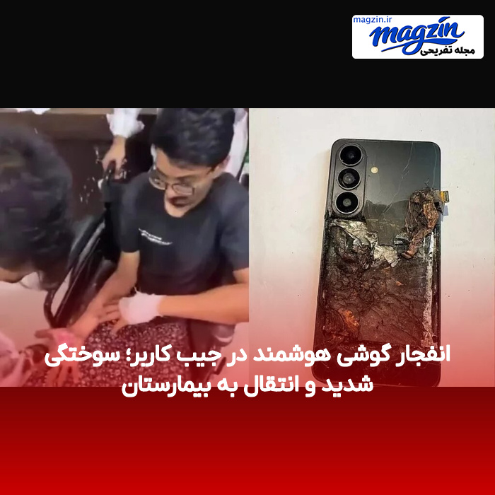 انفجار گوشی هوشمند در جیب کاربر؛ سوختگی شدید و انتقال به بیمارستان